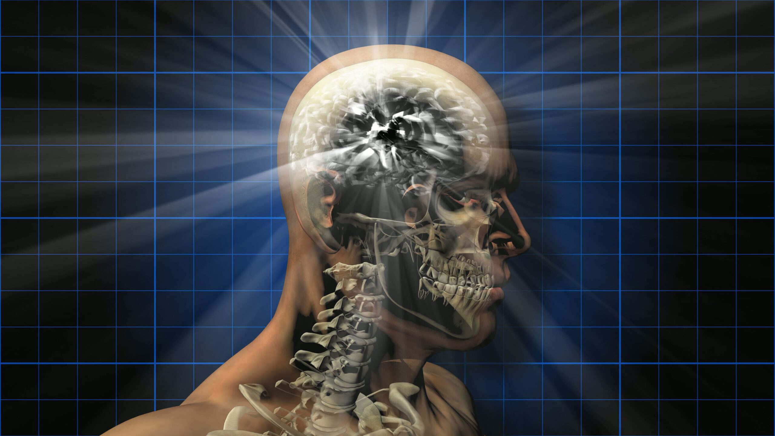 Brain X-ray with Radiant Light Loop