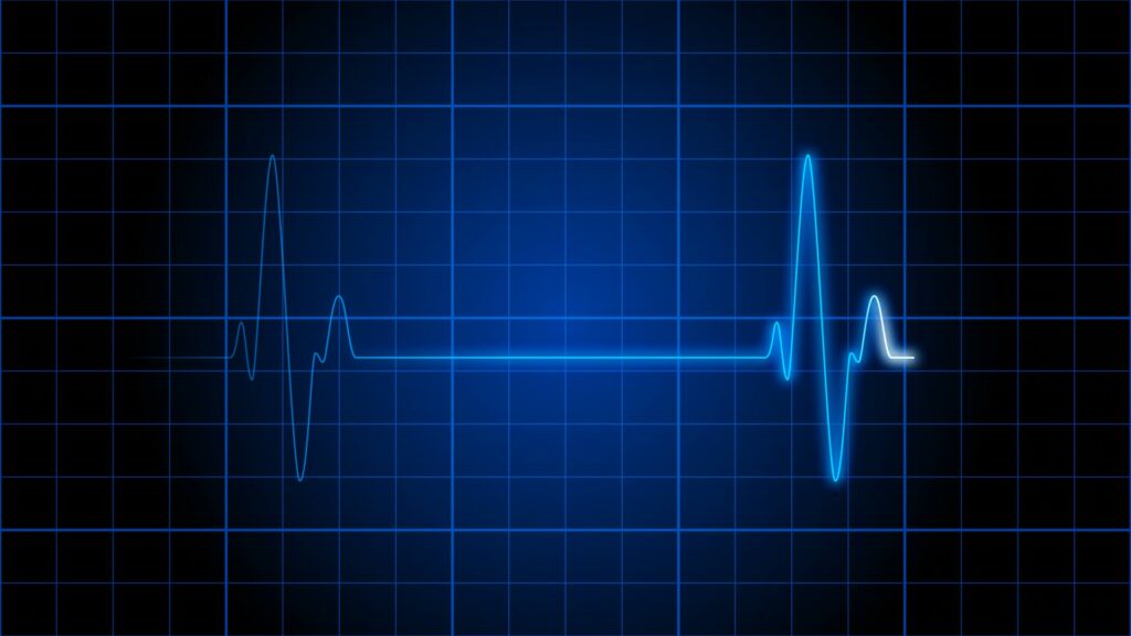 Bright blue animating ECG line fluctuating on a blue grid background, illustrating heart rhythm and medical monitoring.