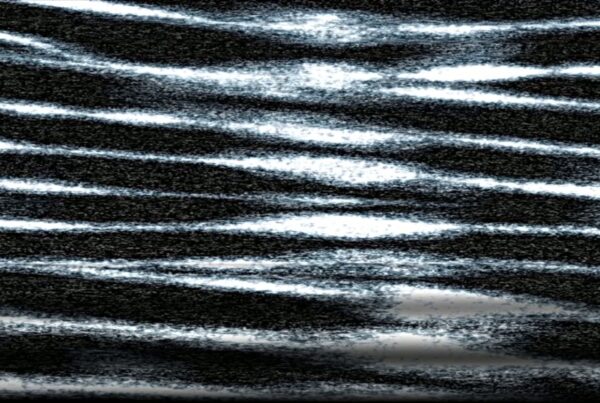 An abstract video loop featuring a rolling monochrome static noise pattern with wavy horizontal lines, evoking a sense of interference and distortion, reminiscent of an analog television screen.