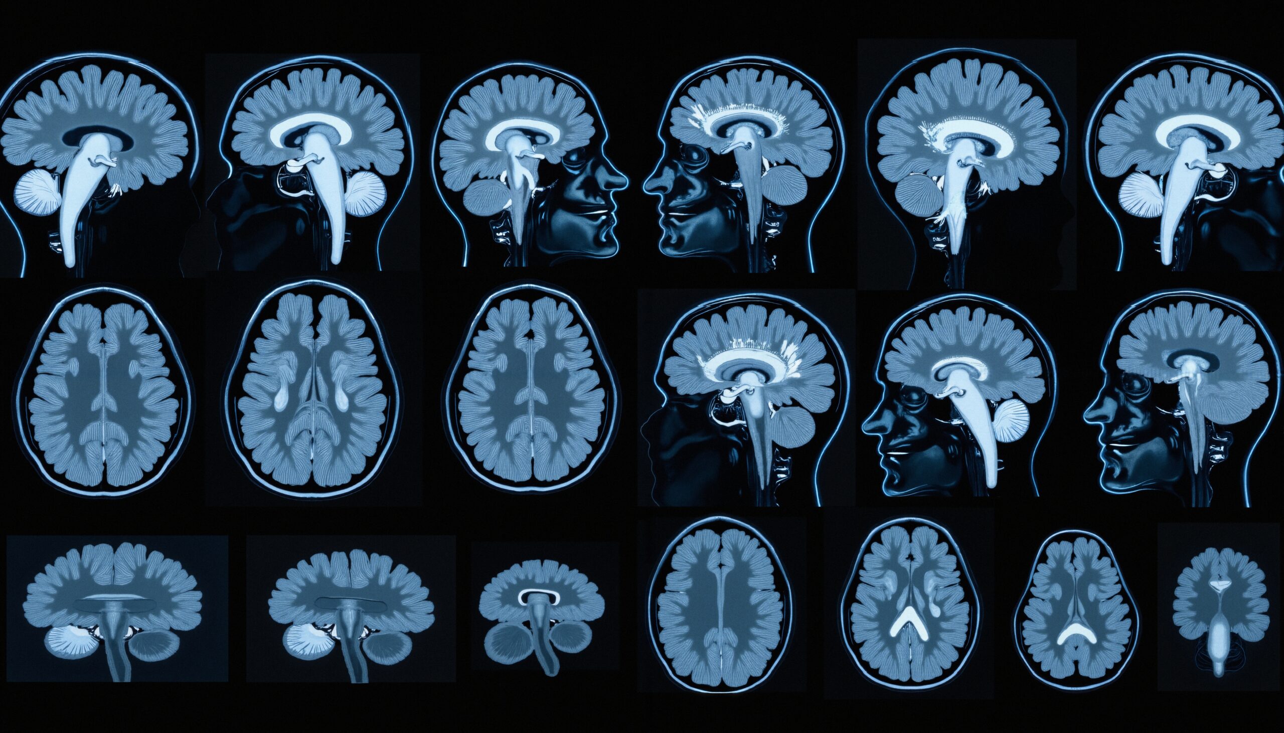 Brain Mapping Through Medical Imaging